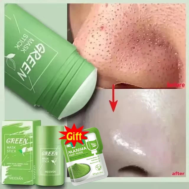 S55f1545111f84cce84f1f2e715e7968cD